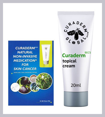 SunSpot ES Vs. Curaderm: Comparing Topical Skin Cancer Treatments