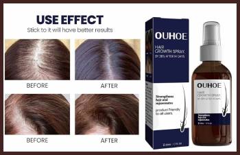 ouhoe hair growth effect