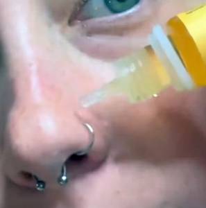 Piercing Bump Solution