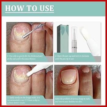 SI Health Nail Care Pen