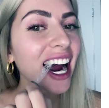 wella white teeth whitening
