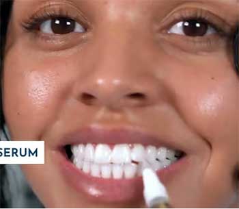 wella white teeth whitening