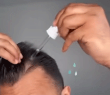 champo hair growth serum reviews
