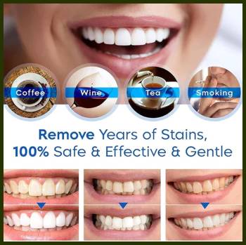 Clevrmart Teeth Whitening Pen