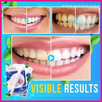 Clevrmart Teeth Whitening Pen