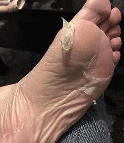 dr scholl's exfoliating foot mask reviews