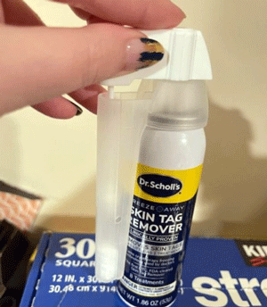 dr scholl's freeze away skin tag remover reviews