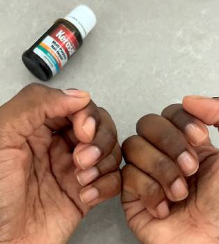 Kerasal Multi-Purpose Nail Repair