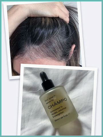 Chāmpo Pitta Growth Serum