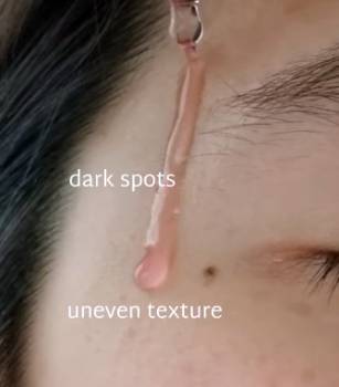 Anua Dark Spot Correcting Serum