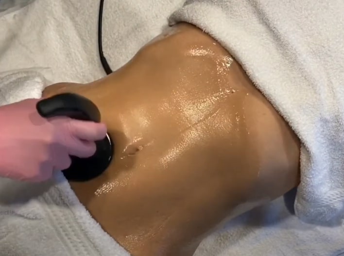 Alastin TransFORM Body Treatment
