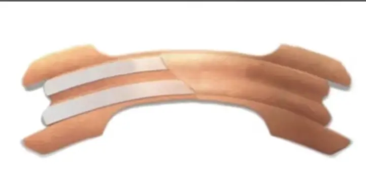 Breathe Right Extra Strength Nasal Strips