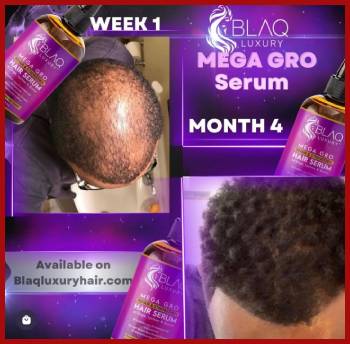 Blaq Luxury Hair Growth Serum