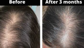 Grow Gorgeous Hair Density Serum Intense