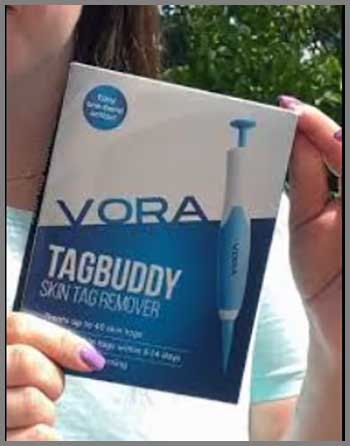 FDA-Cleared Skin Tag Removal Kit