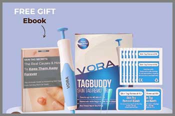 FDA-Cleared Skin Tag Removal Kit