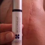 Skinuva Vs Biocorneum