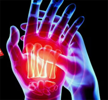 dr brian paris arthritis die