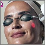 Skin Laundry Laser Facial