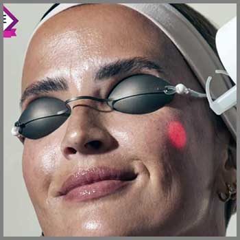 Skin Laundry Laser Facial