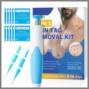 Revivo Skin Tag Remover