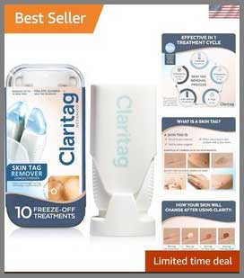 Revivo Skin Tag Remover