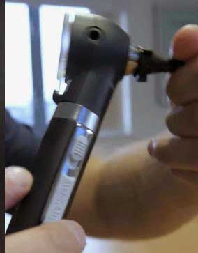 Welch Allyn PocketScope