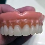Boil and Bite Dentures