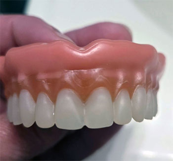 Boil and Bite Dentures