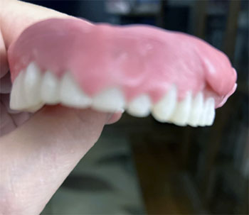 Boil and Bite Dentures
