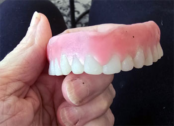 Boil and Bite Dentures