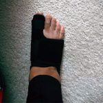Recovist Bunion Brace