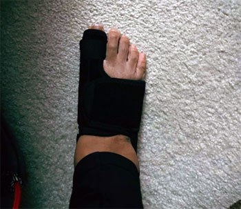Recovist Bunion Brace